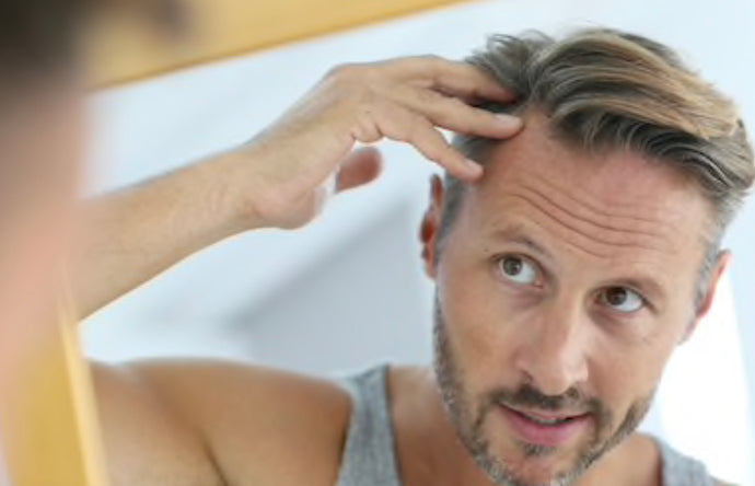 WHAT ARE THE SIGNS OF HAIR LOSS