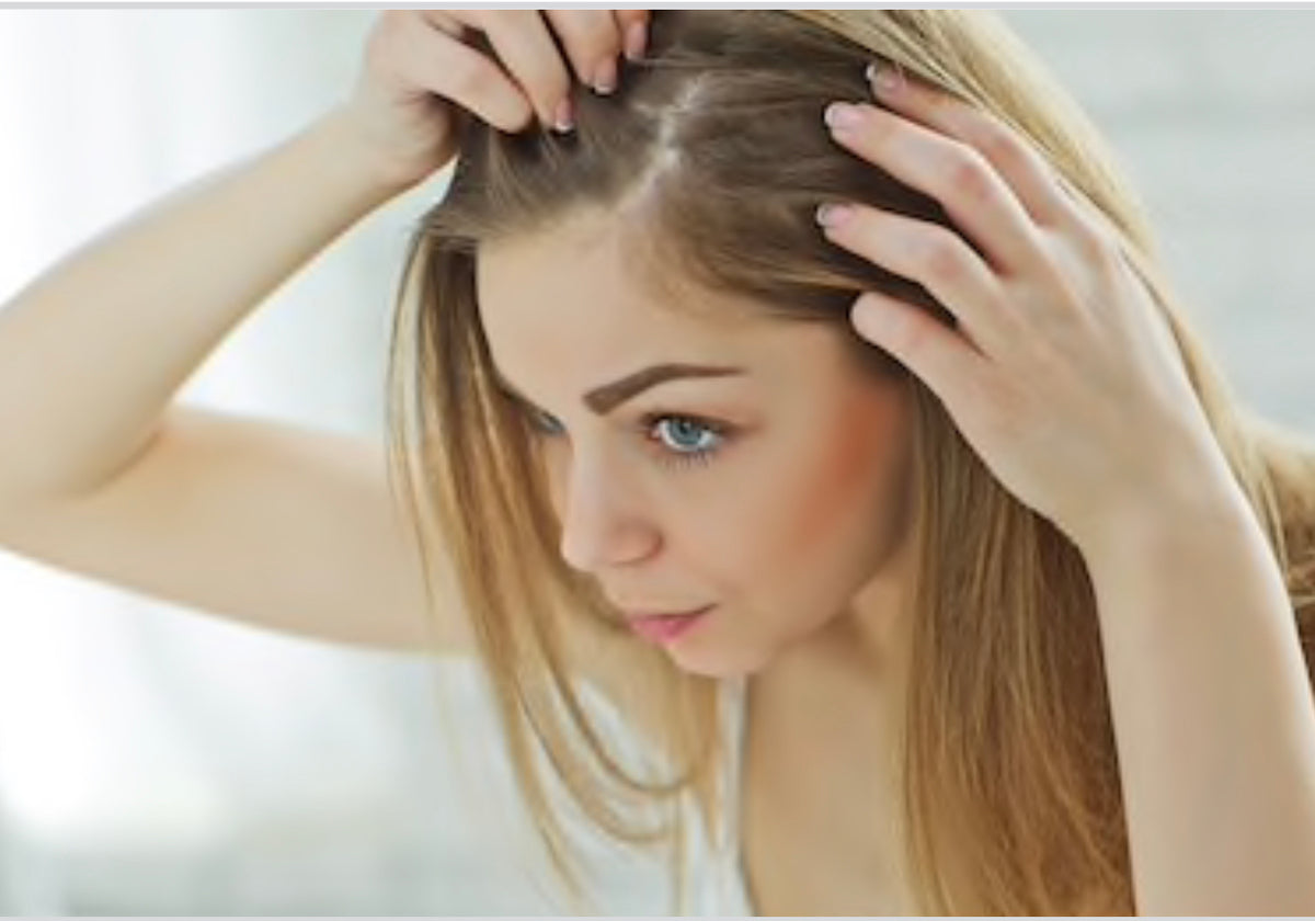 What Causes Hair Loss In Women Cellzgenix